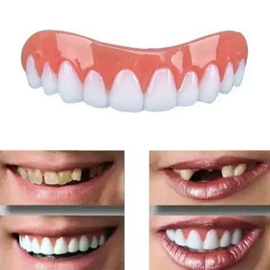 Perfect Smile Silicone Veneers *